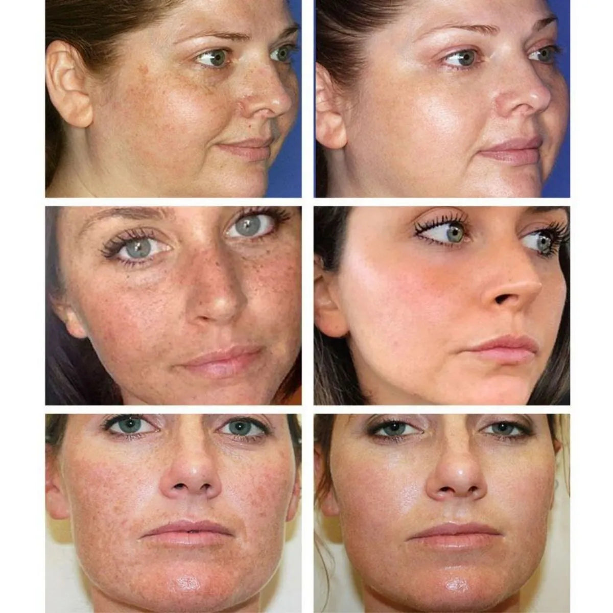 Dark spot correcting cream