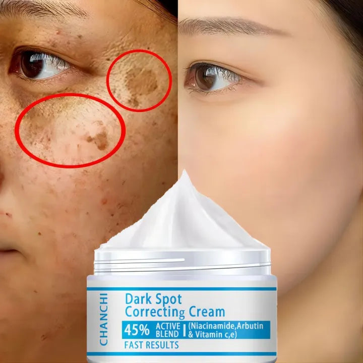 Dark spot correcting cream
